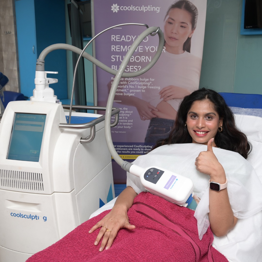 Coolsculpting Treatment